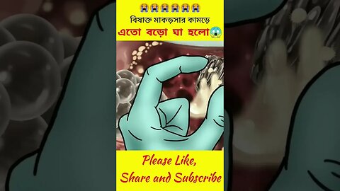 বিষাক্ত মাকড়সার কামড়ে যা হলো😱😱 #shorts #youtubeshorts #viral vocalcandy