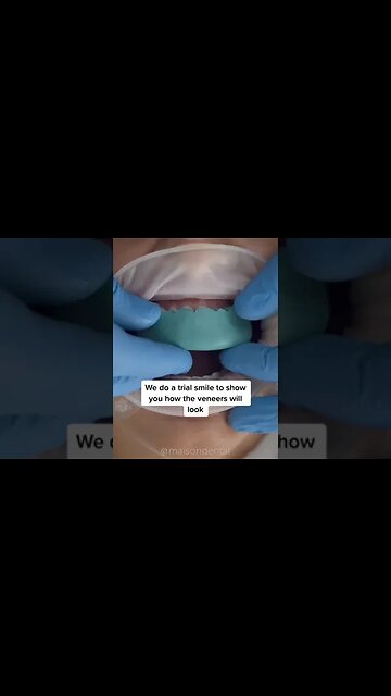 Dental And Teeth Hygiene