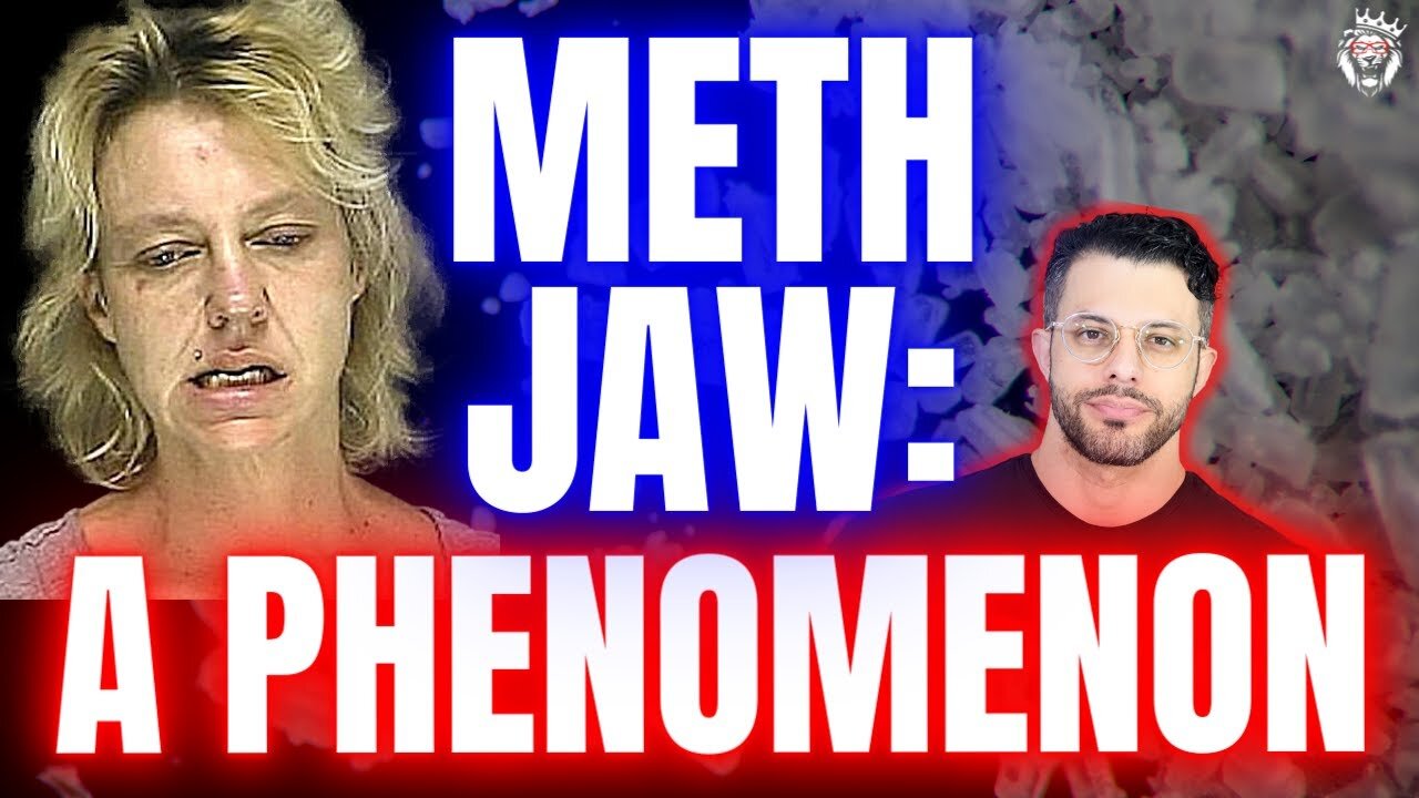 Meth Jaw