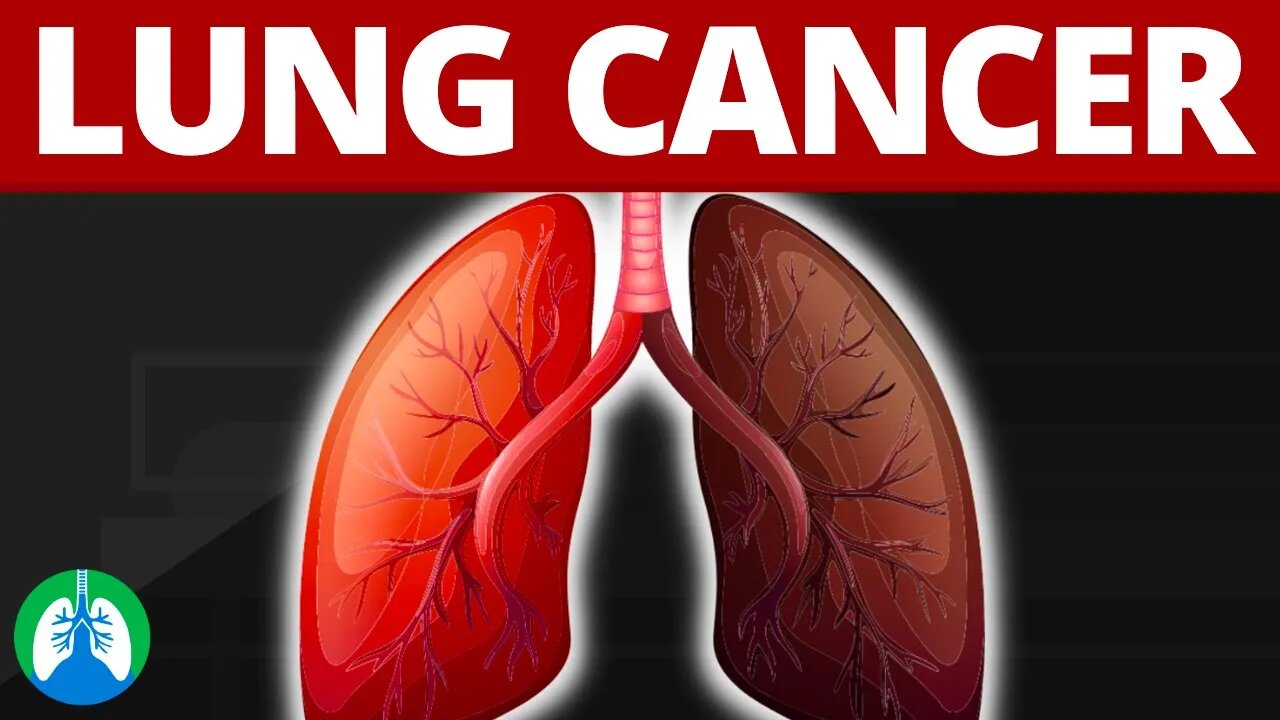 What is Lung Cancer? (Medical Definition)