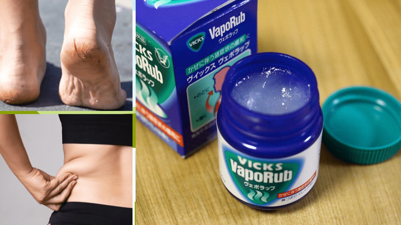 Most Popular Uses of Vicks VapoRub | 22 Effective Uses of Vicks VapoRub