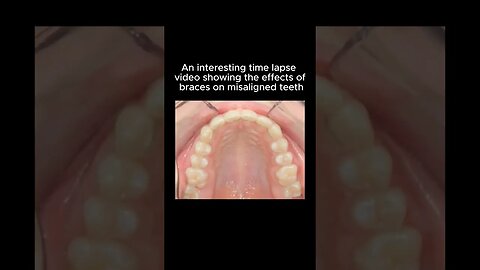 Props to the guy who kept his mouth on camera for 6 months