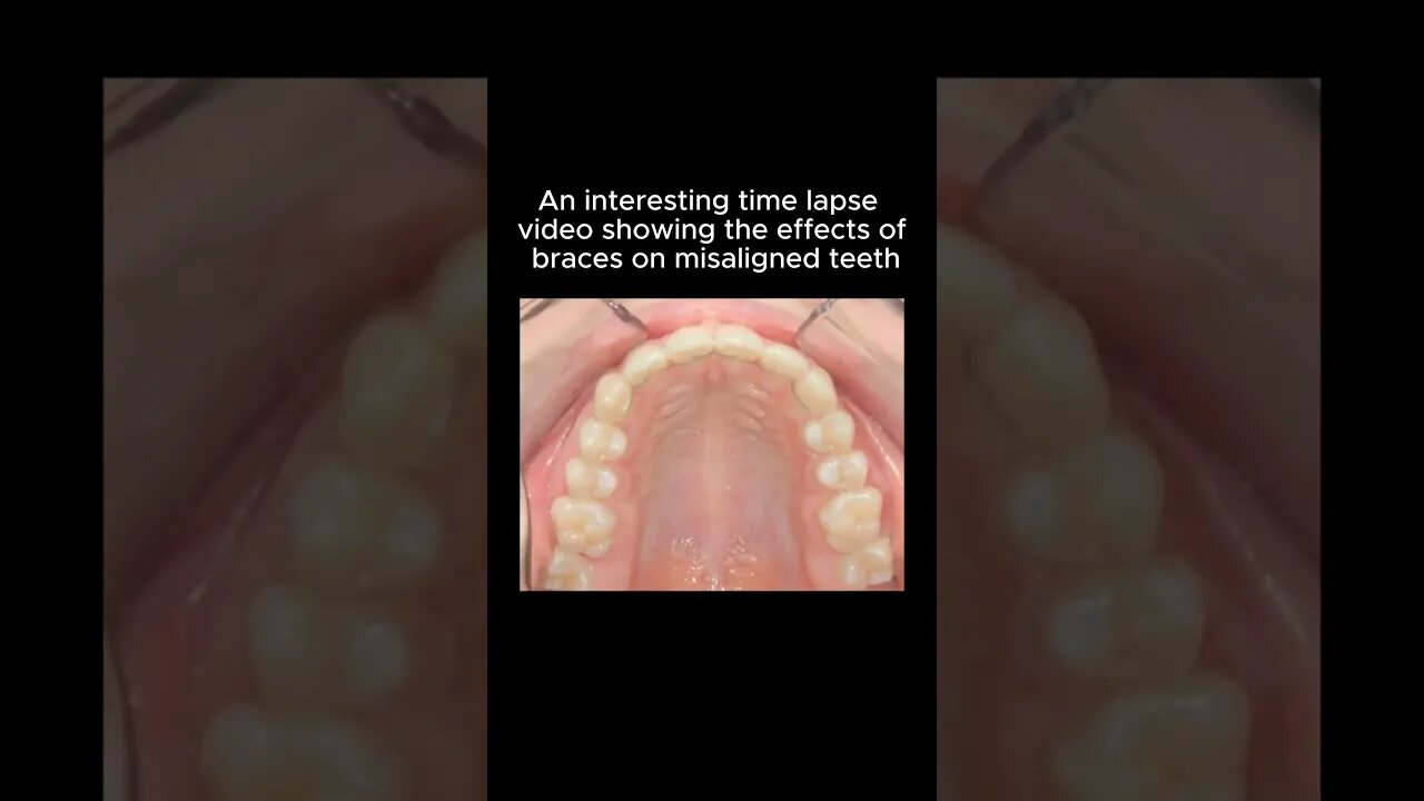 Props to the guy who kept his mouth on camera for 6 months