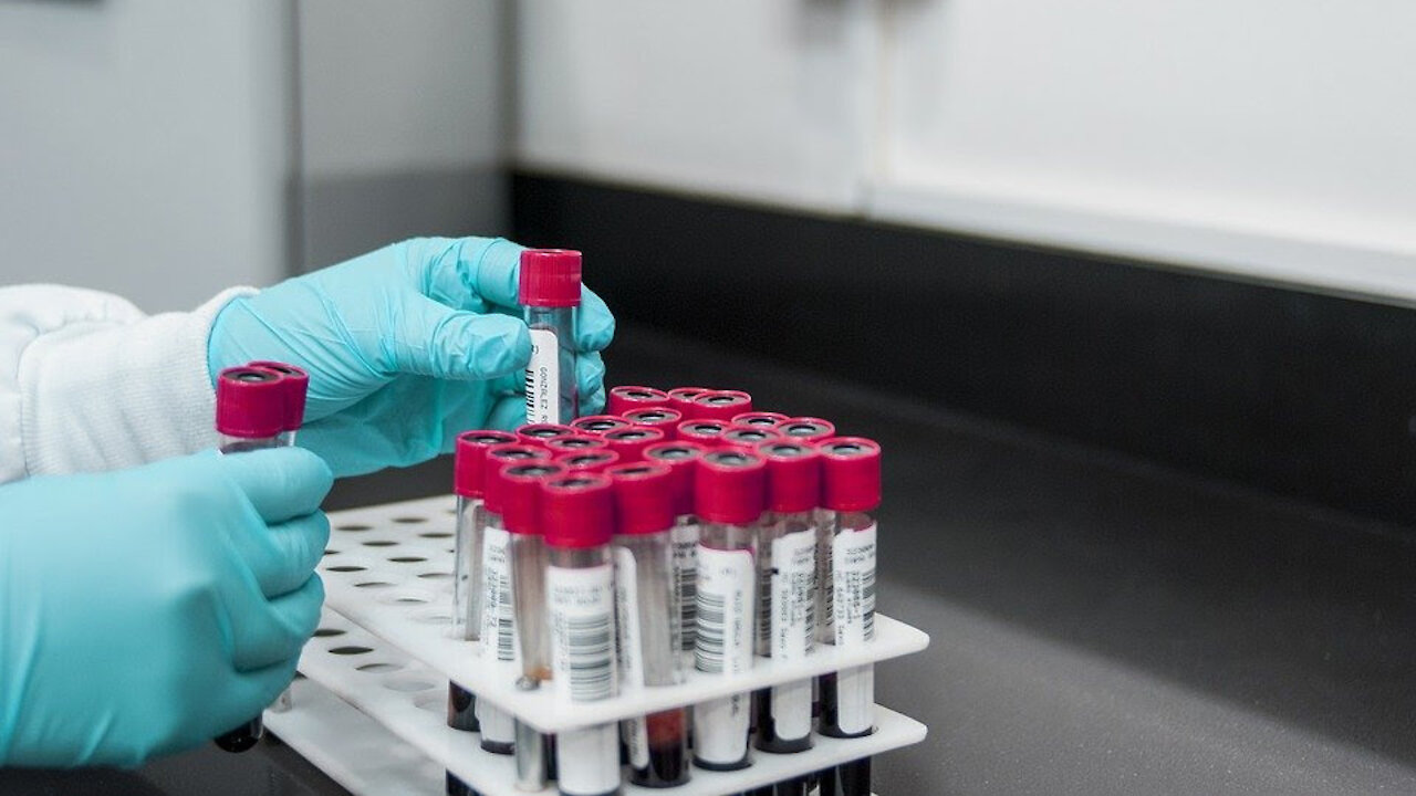 CDC Test Change Reveals They Were NEVER Testing for COVID-19