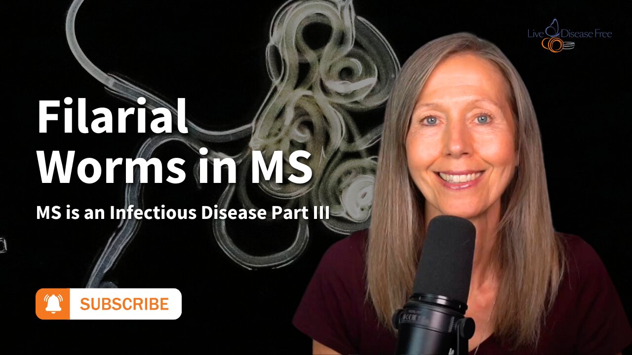 MS is an Infectious Disease Part 3: Filarial Worms in MS