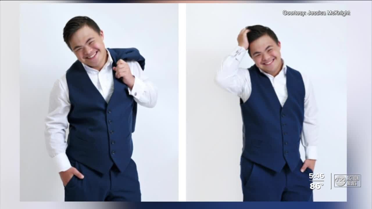 Local fashion model with down syndrome starts successful career