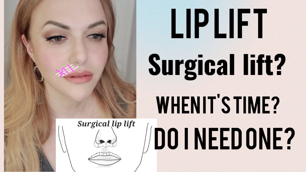 Lip Lift w/ Threads