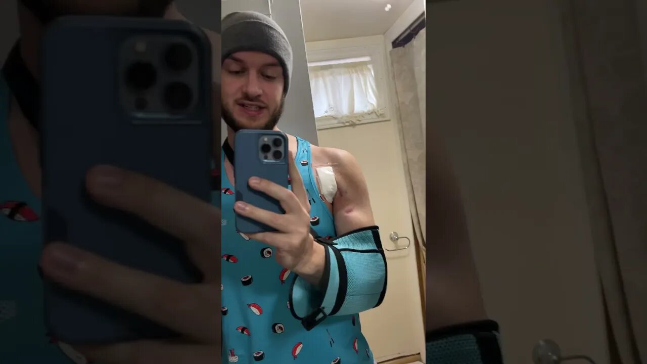 Two Days Until Surgery 😬