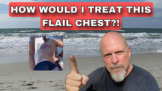 How would I treat this Flail Chest?!