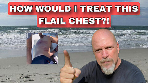How would I treat this Flail Chest?!
