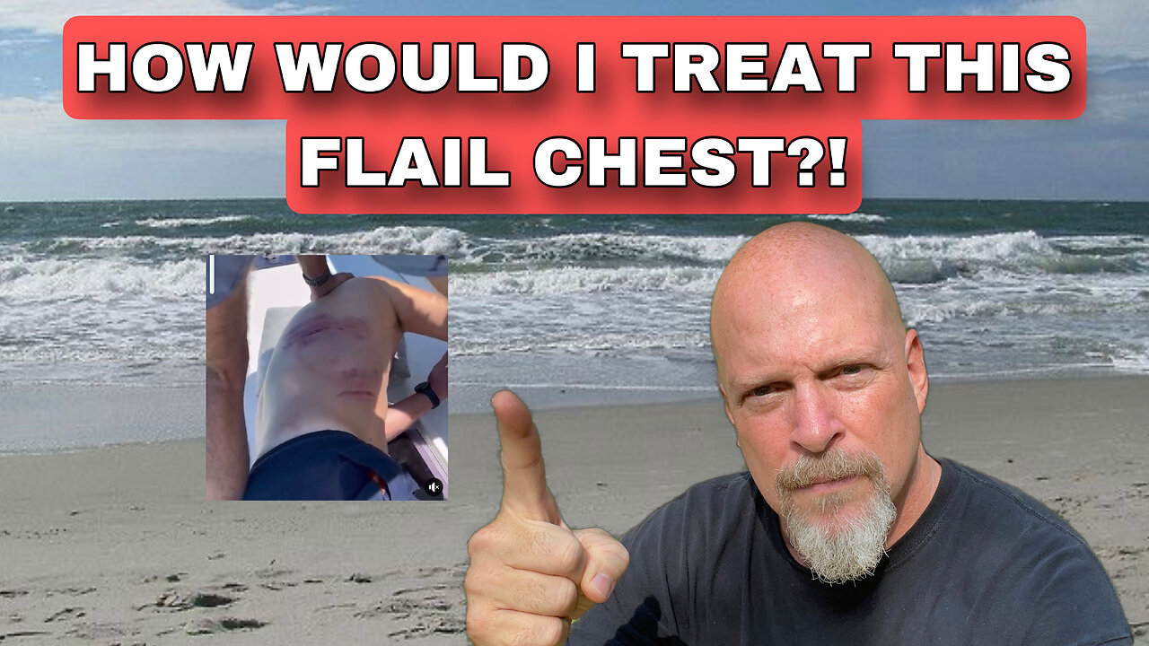 How would I treat this Flail Chest?!