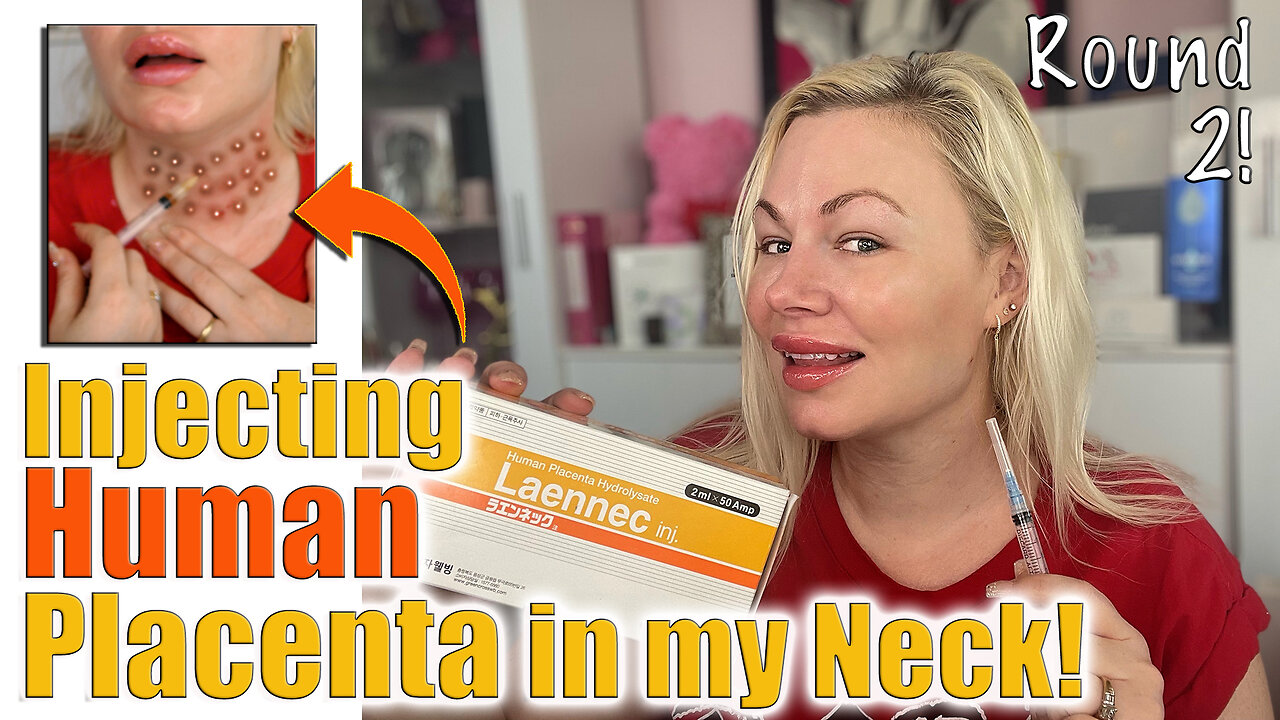 Injecting Human Placenta in my Neck, Round 2 from AceCosm.com | Code Jessica10 Saves you Money $$$