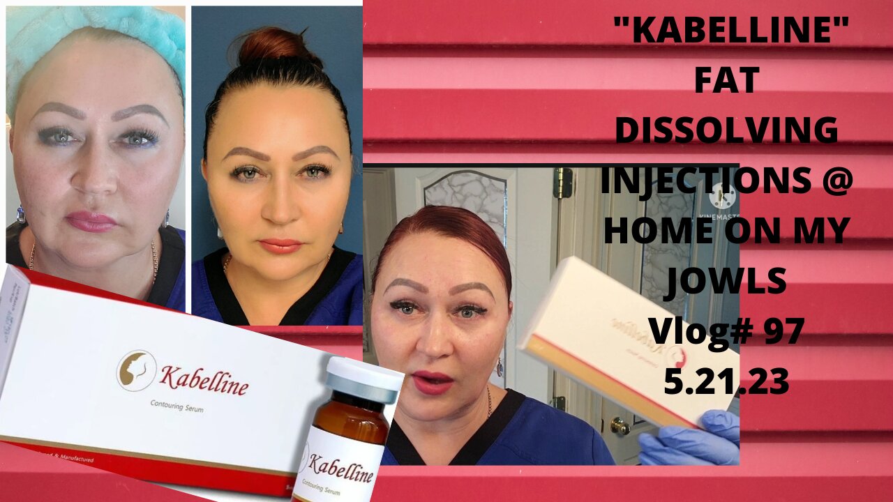 KABELINE +LIPORASE JAWLINE INJECTIONS AT HOME ! VLOG#97 05.21.23 #kabellineinjections