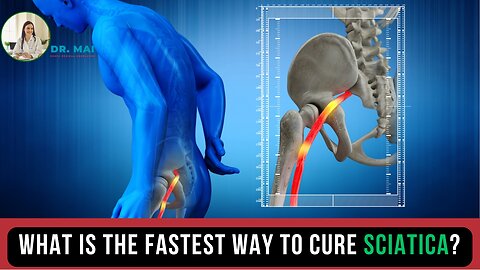 What is the fastest way to cure sciatica? | DR. MAI