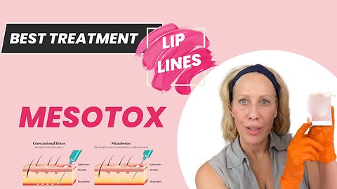 Get Rid of Lip Lines with Mesotox