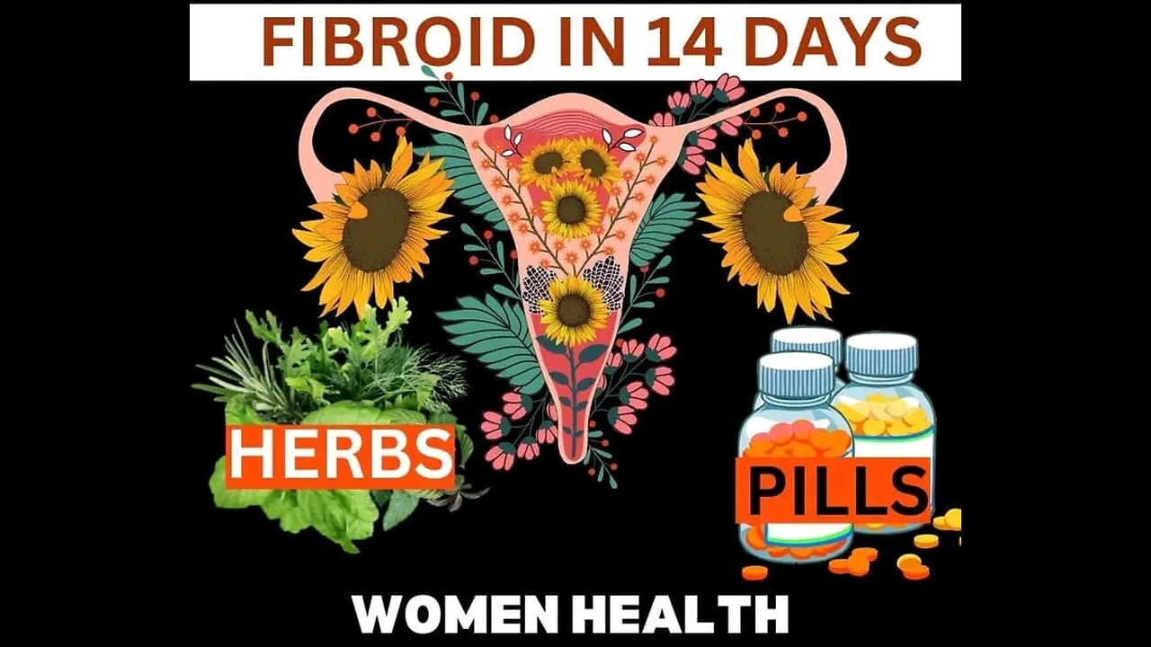 Fibroid Surgey - Not YET!