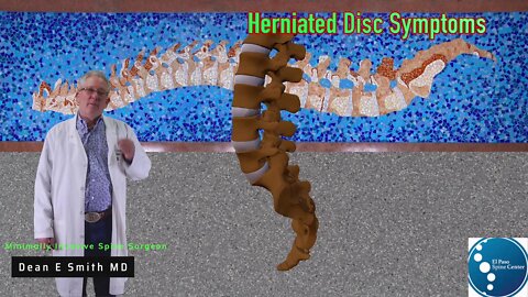 Lumbar Disc Herniation