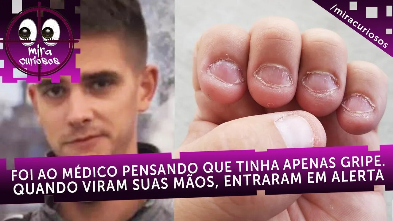 Ele foi ao médico pensando que estava com gripe. Quando viram suas mãos, entraram em alerta