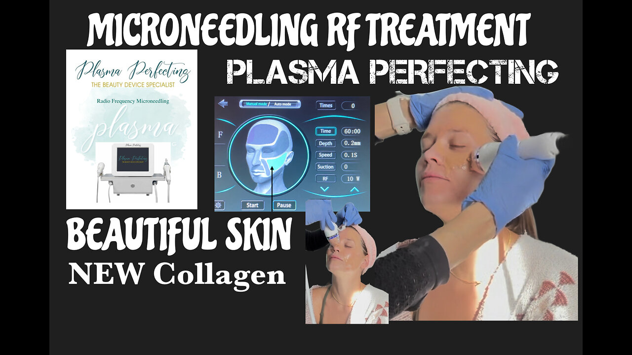 Best Skincare Treatment Microneedling RF