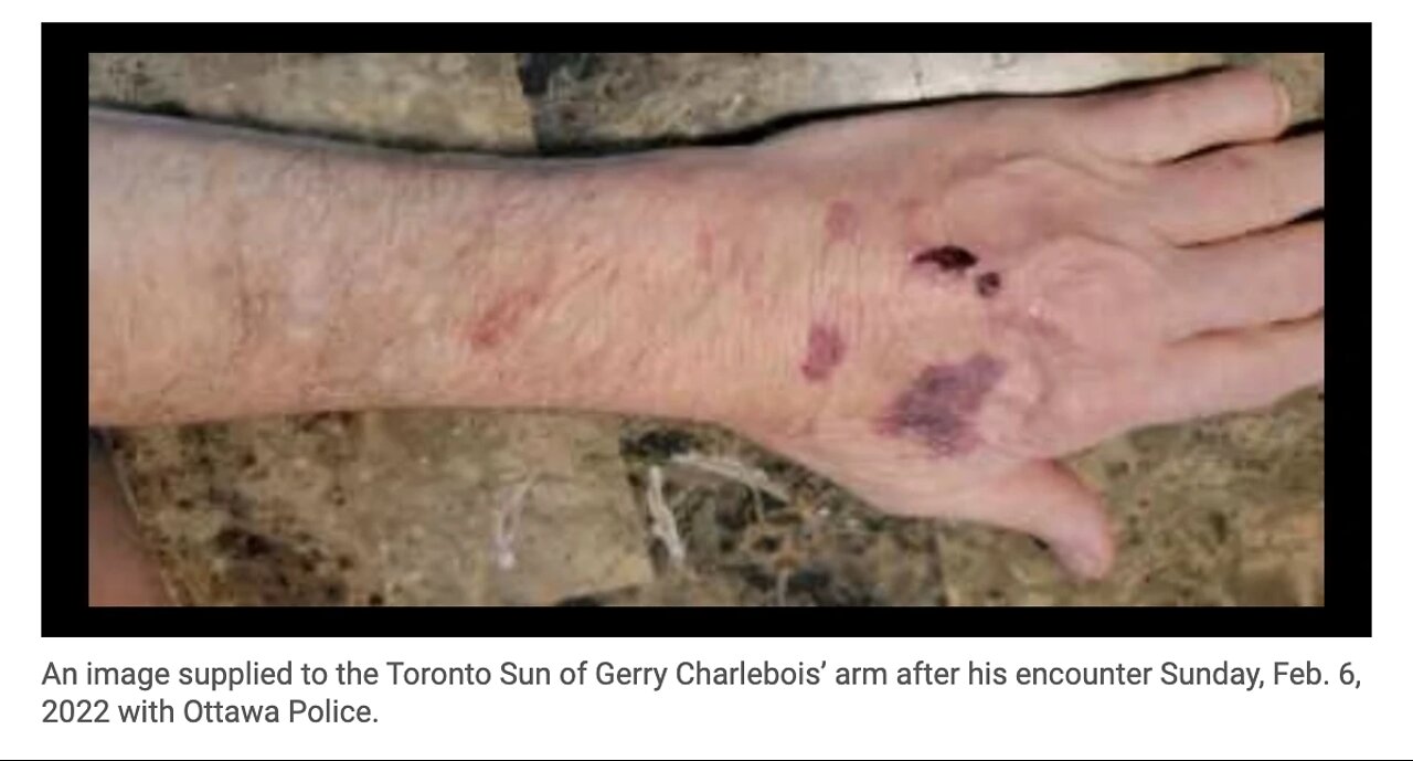 80 yr old man abused by ottawa police and canadian media dont care, no one cares