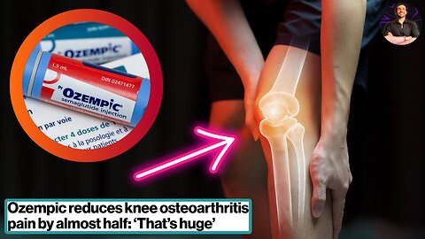Ozempic Does It Again! Solving Osteoarthritis Pain, One Jab at a Time!