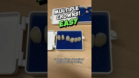 don’t cement the Wrong crown onto the Wrong tooth