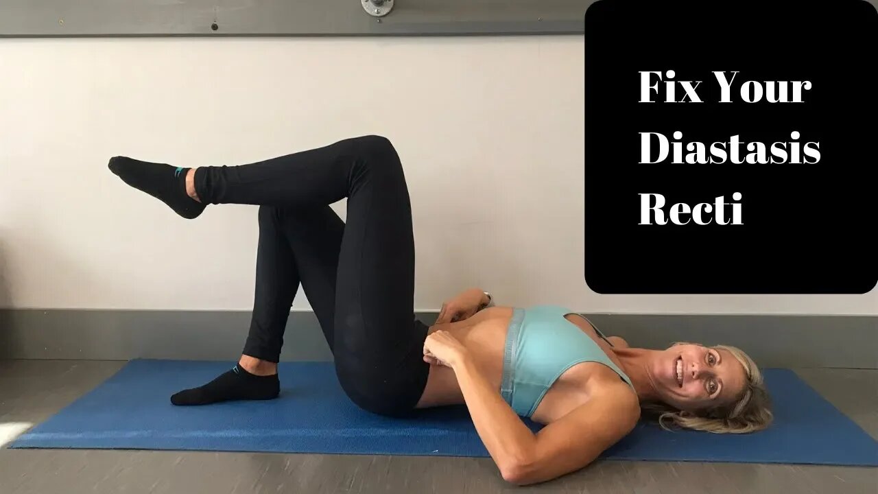 Fix Your Diastasis Recti- Exercises For Abdominal Separation