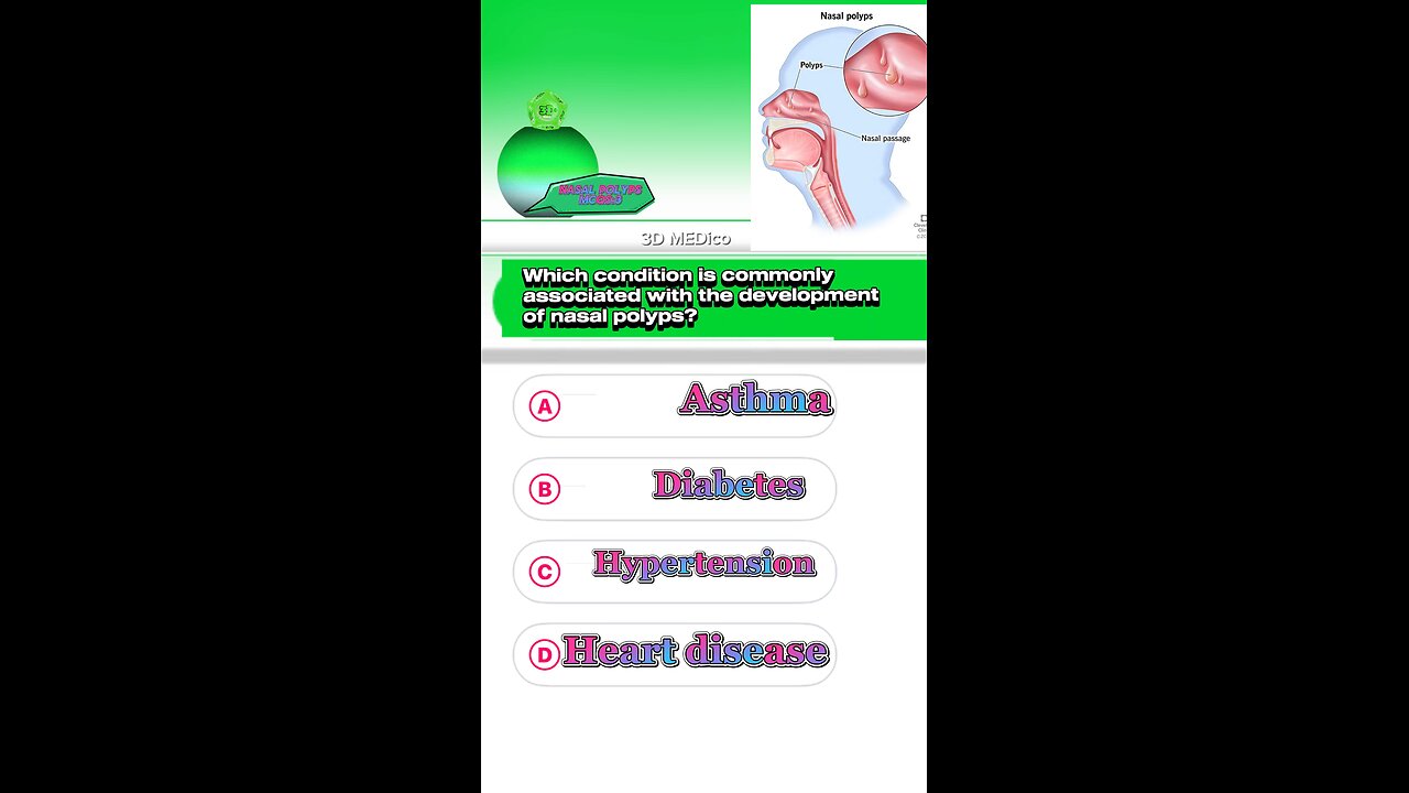 Nasal polyps question answer mcqs #shormcqs #Nasalpolyps #disease #breathing #medication