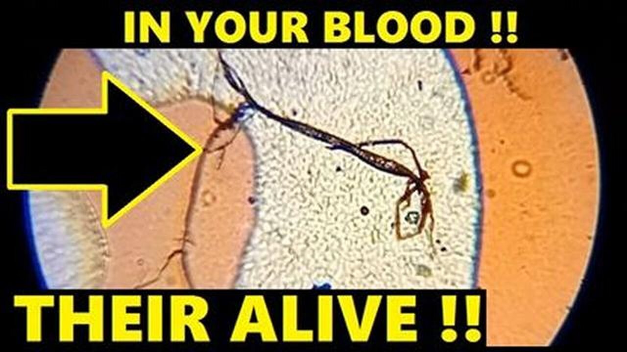 CREATURES GROWING IN UNVAXXED BLOOD!!