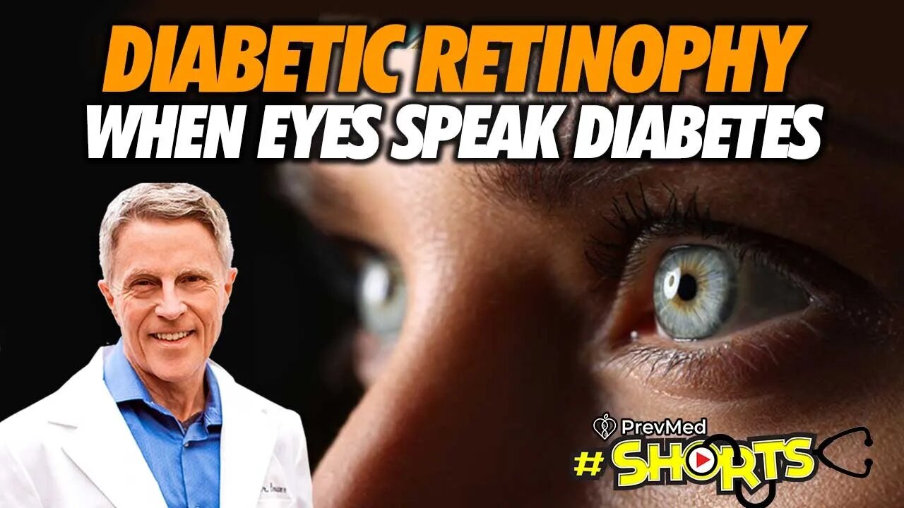 #SHORTS Diabetic Retinophy - When Eyes Speak Diabetes