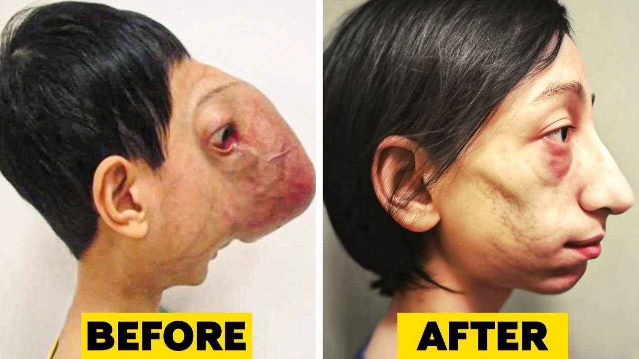 15 Kids Who Had Extreme Plastic Surgery