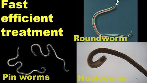 How to treat: roundworm, pinworms, hookworms... Quick easy and without prescription.