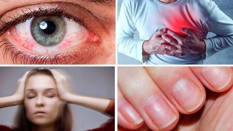 7 Scary Symptoms That Are Usually Harmless