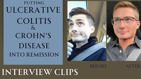 Ulcerative Colitis, Crohn’s disease into remission on Carnivore diet