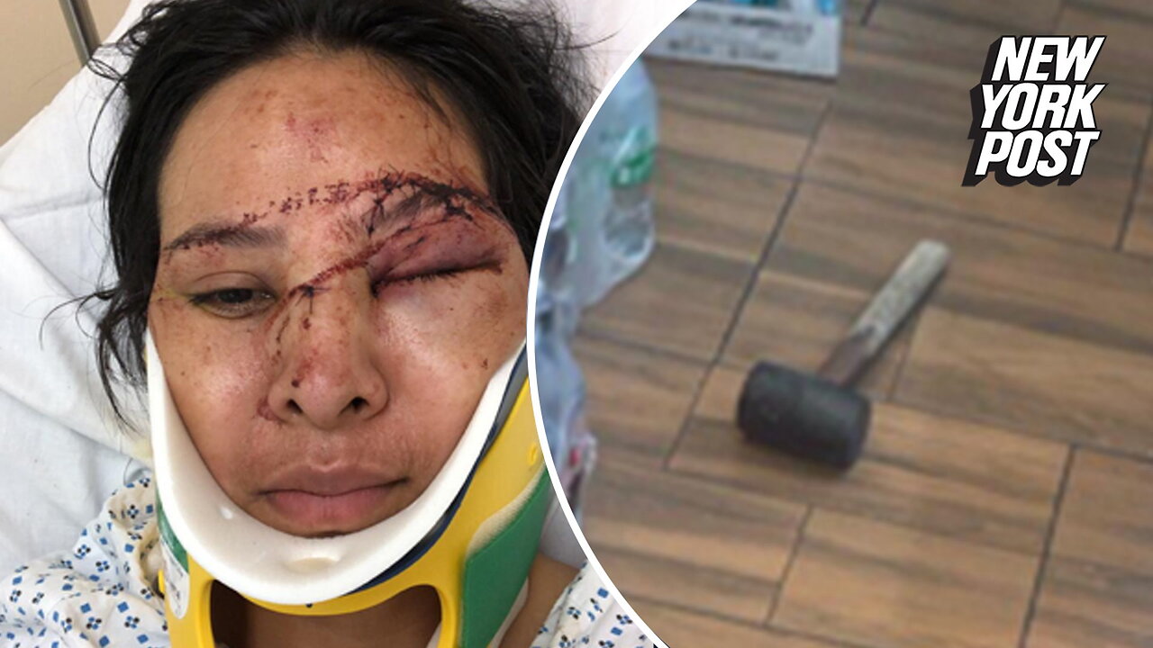 Mom wounded in vicious bodega hammer attack: 'She didn't deserve what happened'