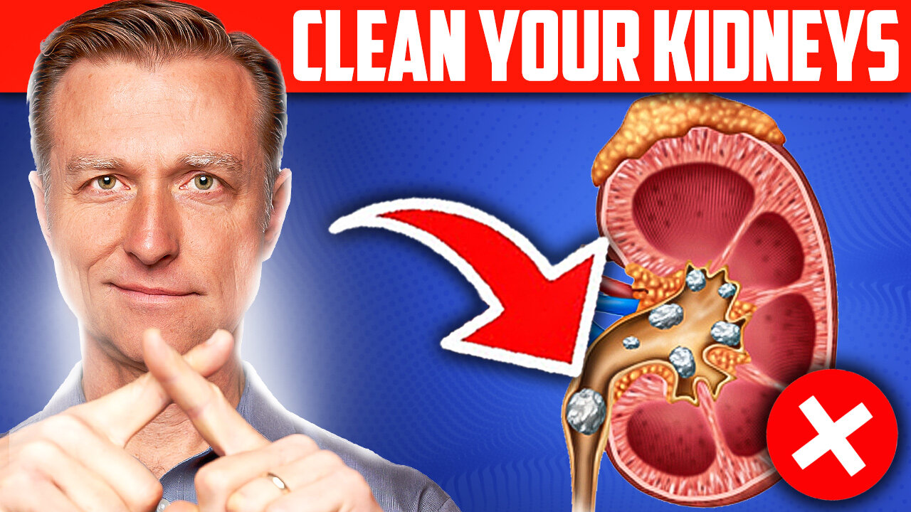 Clean Your Kidneys of Uric Acid and Oxalates