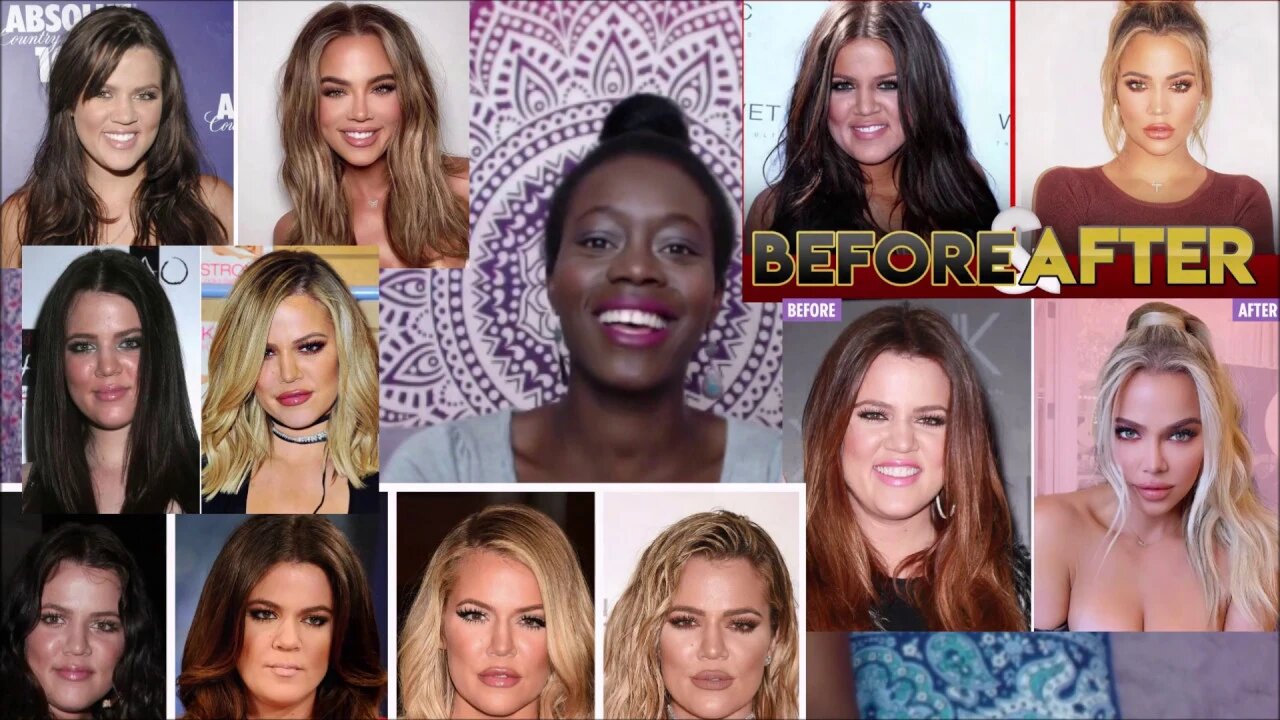 Khloe Kardashian's Many Many Faces 😨 | Plastic Surgery | Liposuction | Butt Implants | EPISODE 3