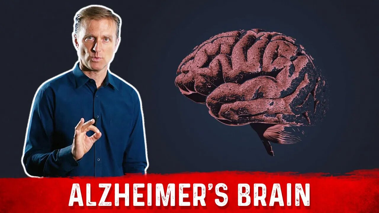 What is Alzheimer's Disease? – The Alzheimer's Brain – Dr.Berg