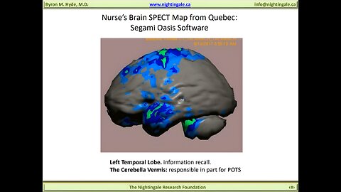 Nurse's Brain SPECT Scan taken with a Lumbar Puncture case - Byron Hyde, MD