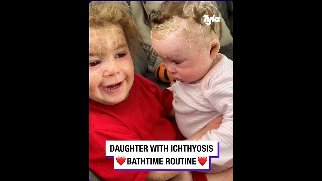 Daughter with lcthyosis night time routine