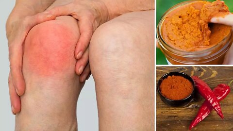 All Natural Homemade Cream for Arthritis & Joint Pain