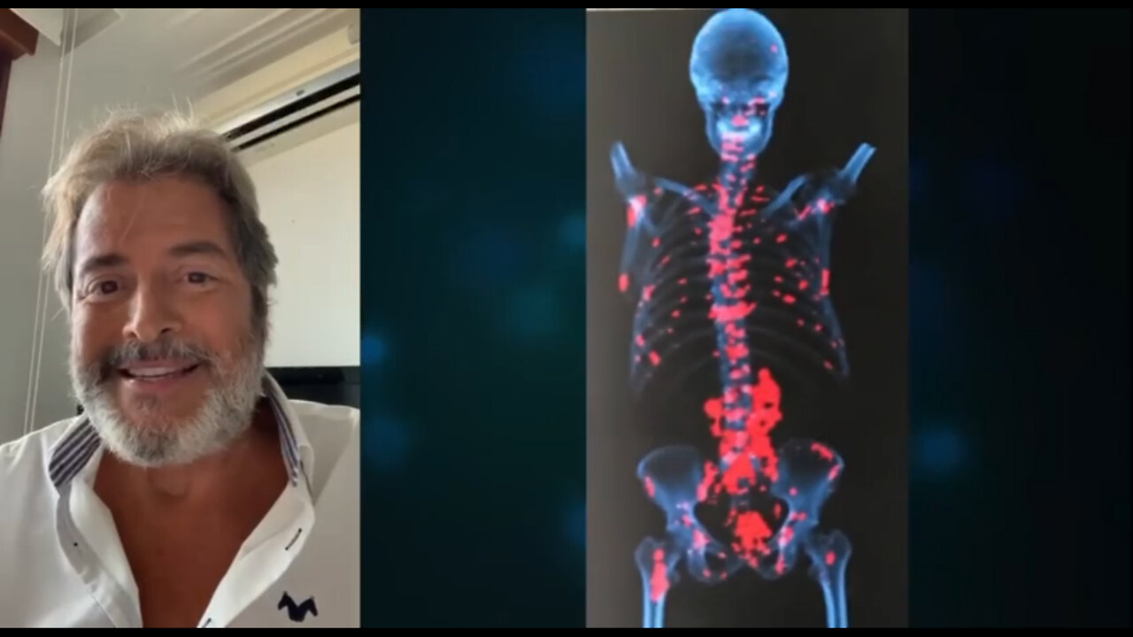 CÁNCER DE PRÓSTATA EN ESTADO TERMINAL TIENE CURA