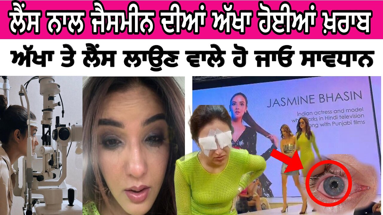 TV ਐਕਟਰਸ ਨੂੰ ਅੱਖਾਂ ਤੇ Lense ਲਗਾਉਣ ਕਾਰਨ ਗਈ ਅੱਖਾਂ ਦੀ ਰੋਸ਼ਨੀ, Lenses ਲਗਾਉਣ ਵਾਲੇ ਹੋ ਜਾਓ ਸਾਵ**ਧਾਨ