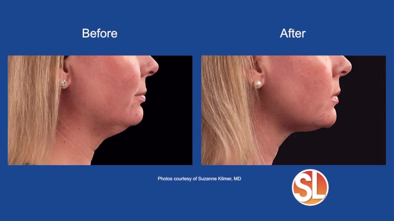 Dr. Fabi has the details on the latest advancements aesthetics