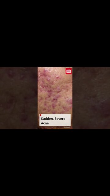 Warning Signs of Infertility You Shouldn’t Ignore. #shorts