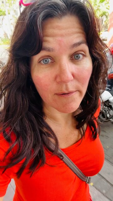 My life would be scars easier if I weren’t so fussy🤔