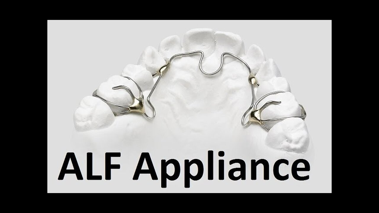 Orthodontic Treatment Using Advanced Lightwire Functional ALF Appliances by Prof John Mew