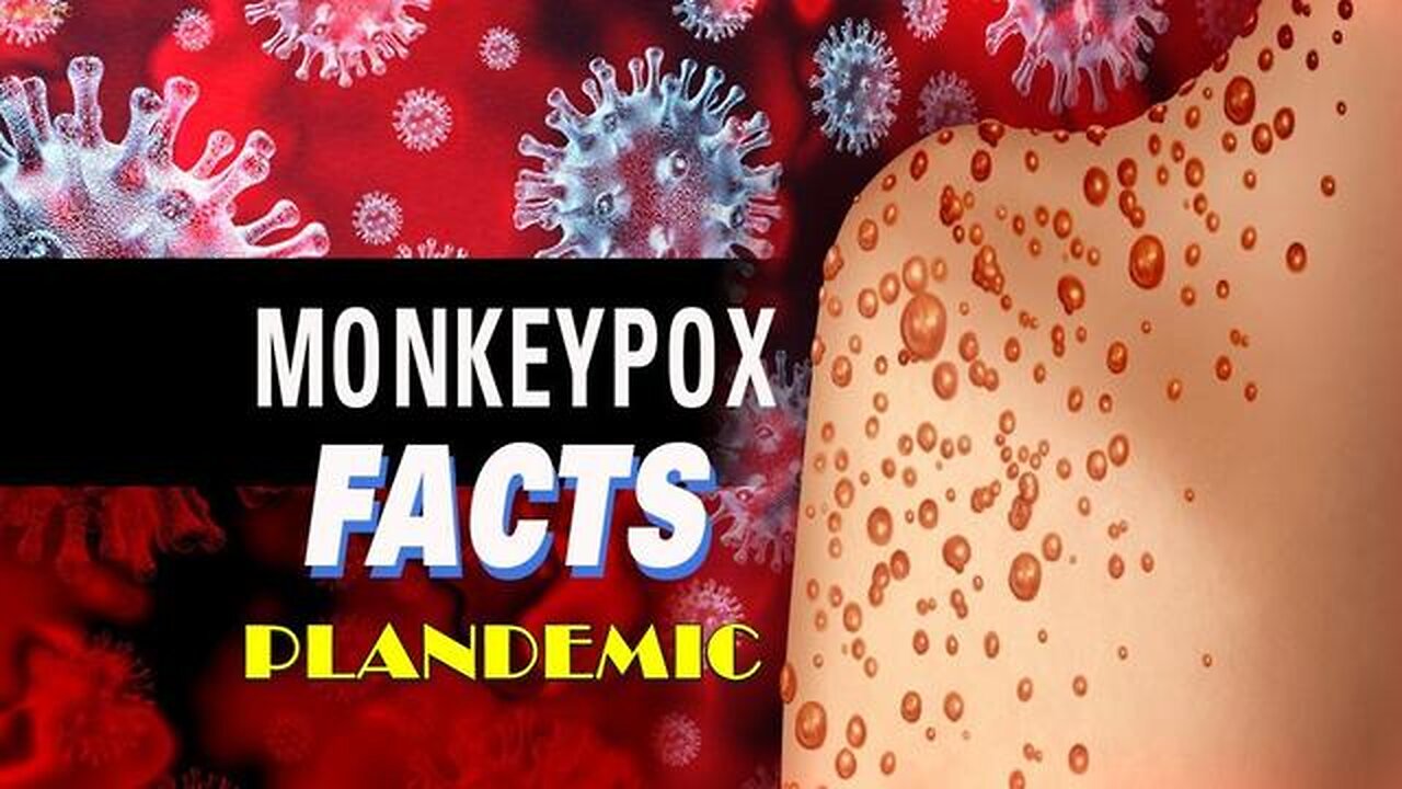 The Truth About The Monkey Pox (Mpox) Plandemic