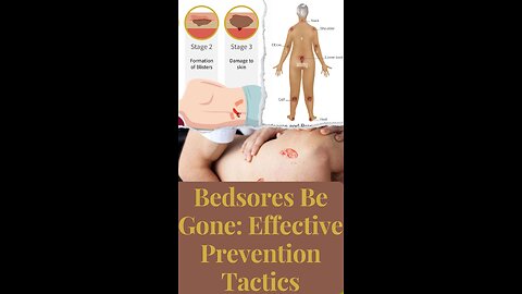 Bedsores go away: effective prevention strategy