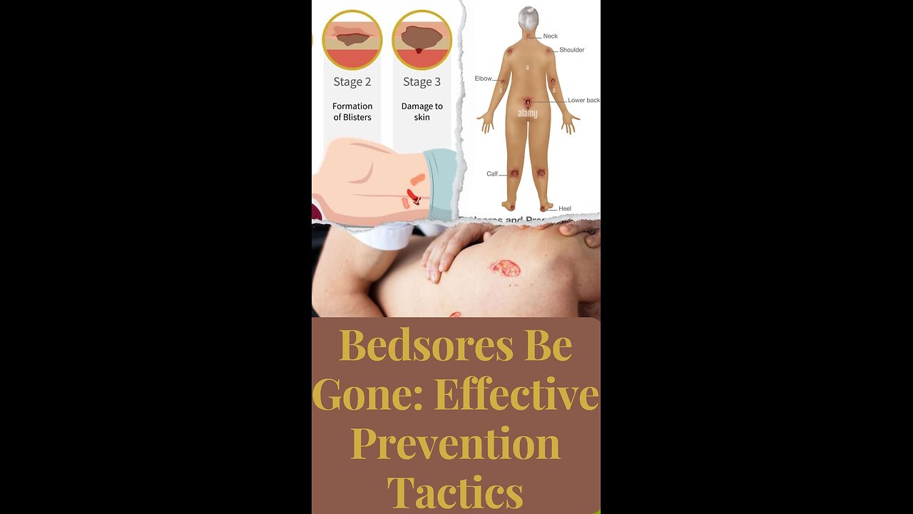 Bedsores go away: effective prevention strategy